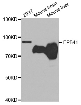 Band 4.1 / EPB41 Antibody - Western blot analysis of extracts of various cell lines.