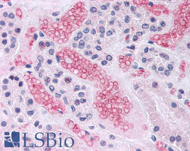 Band 4.1 / EPB41 Antibody - Human Kidney: Formalin-Fixed, Paraffin-Embedded (FFPE)