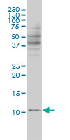 BANF1 / BAF / BCRP1 Antibody - BANF1 monoclonal antibody, clone 3F10-4G12 Western blot of BANF1 expression in Jurkat.