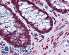 BANF1 / BAF / BCRP1 Antibody - Anti-BANF1 antibody IHC of human colon. Immunohistochemistry of formalin-fixed, paraffin-embedded tissue after heat-induced antigen retrieval. Antibody concentration 5 ug/ml.