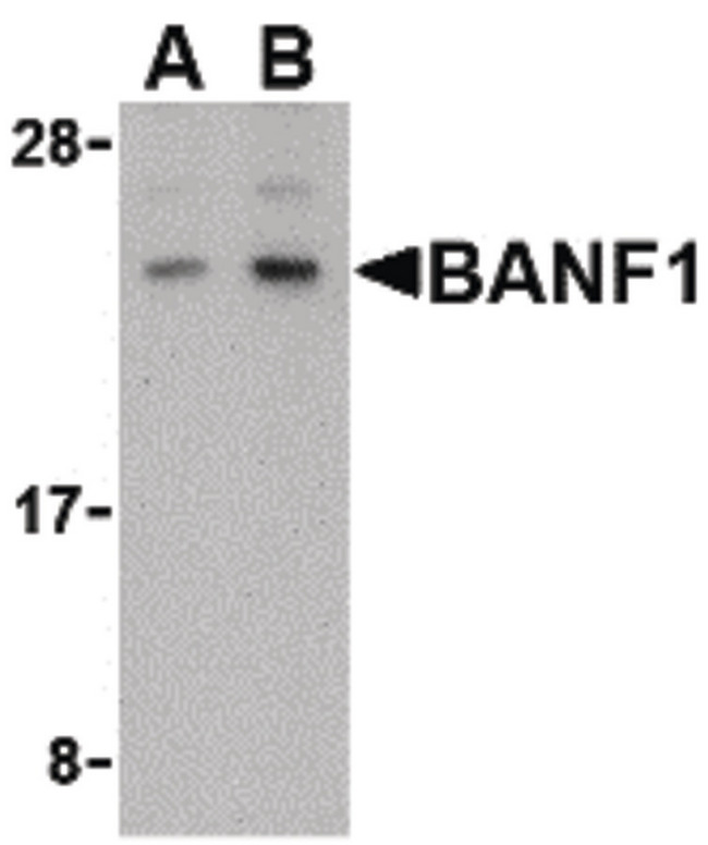 BANF1 / BAF / BCRP1 Antibody - Western blot of BANF1 in human kidney tissue lysate with BANF1 antibody at (A) 0.5 and (B) 1 ug/ml.