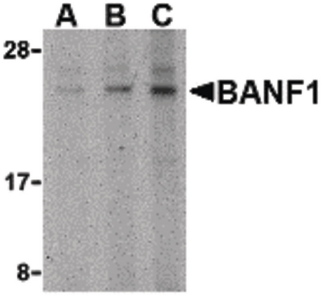 BANF1 / BAF / BCRP1 Antibody - Western blot of BANF1 in mouse kidney tissue lysate with BANF1 antibody at (A) 0.5, (B) 1 and (C) 2 ug/ml.