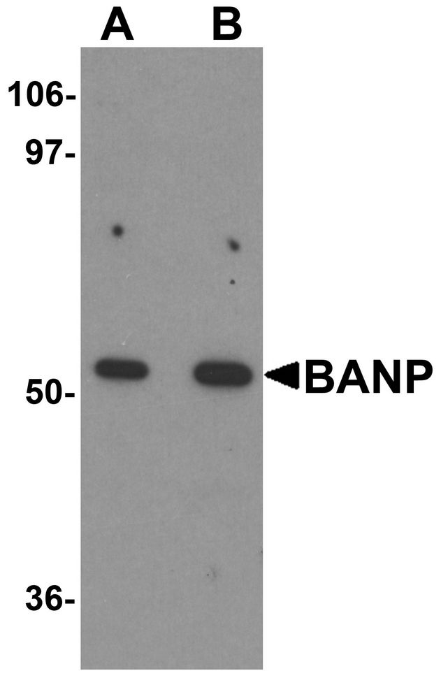 BANP Antibody - Western blot analysis of BANP in mouse kidney tissue lysate with BANP antibody at (A) 1 and (B) 2 ug/ml.