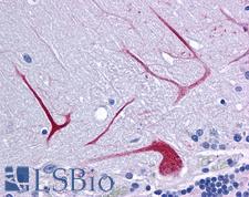 BANP Antibody - Anti-BANP antibody IHC of human brain, cerebellum. Immunohistochemistry of formalin-fixed, paraffin-embedded tissue after heat-induced antigen retrieval. Antibody concentration 5 ug/ml.