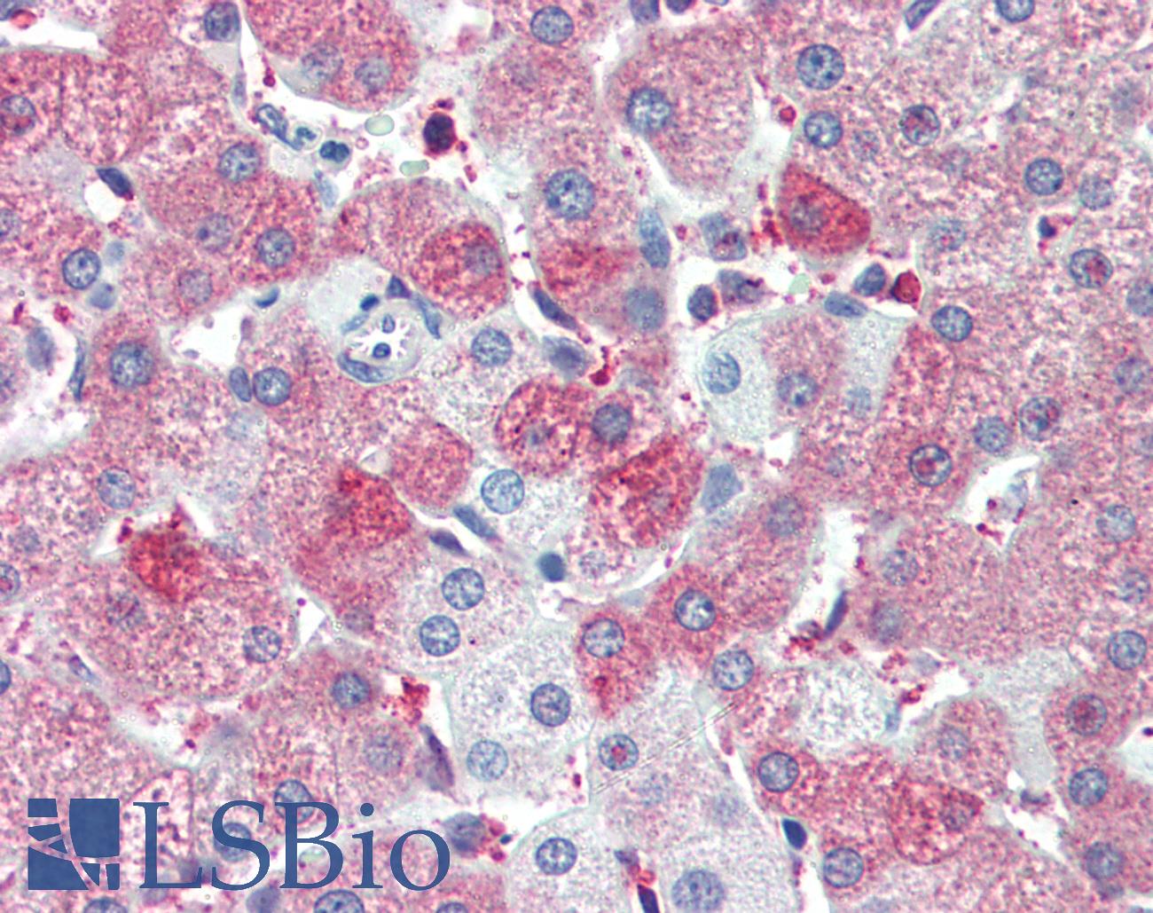 BAP / SIL1 Antibody - Anti-SIL1 antibody IHC of human liver. Immunohistochemistry of formalin-fixed, paraffin-embedded tissue after heat-induced antigen retrieval. Antibody concentration 5 ug/ml.
