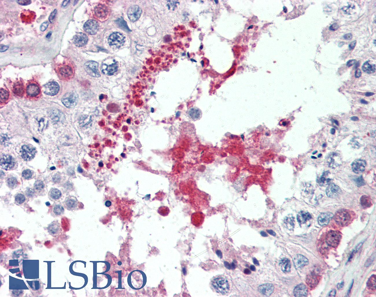 BAP / SIL1 Antibody - Anti-SIL1 antibody IHC of human testis. Immunohistochemistry of formalin-fixed, paraffin-embedded tissue after heat-induced antigen retrieval. Antibody concentration 5 ug/ml.