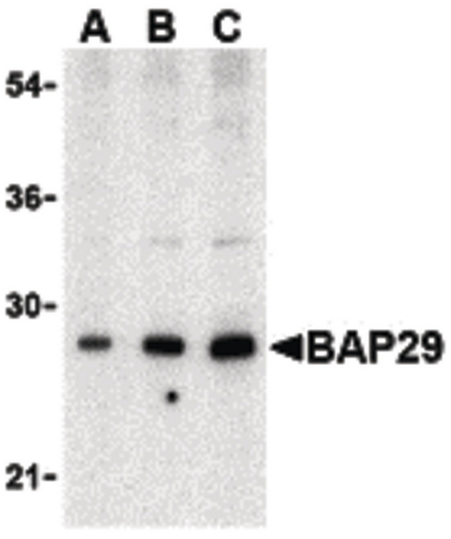 BAP29 / BCAP29 Antibody - Western blot of Bap29 in human heart tissue lysate with Bap29 antibody at (A) 0.5, (B) 1 and (C) 2ug/ml.