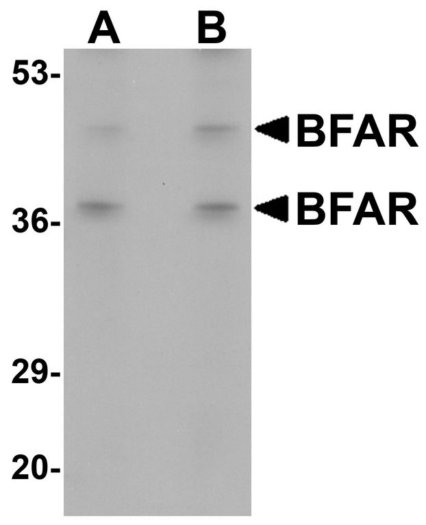 BAR / BFAR Antibody - Western blot analysis of BFAR in human kidney tissue lysate with BFAR antibody at (A) 1 and (B) 2 ug/ml.