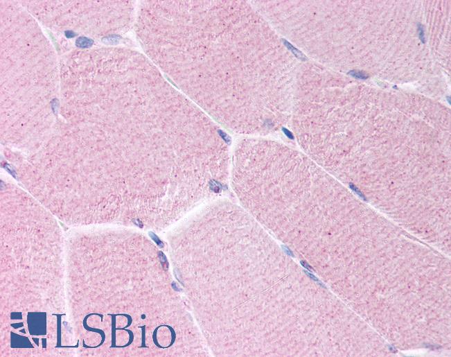 BARD1 Antibody - Anti-BARD1 antibody IHC of human skeletal muscle. Immunohistochemistry of formalin-fixed, paraffin-embedded tissue after heat-induced antigen retrieval. Antibody concentration 10 ug/ml.