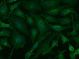 Basigin / Emmprin / CD147 Antibody - Immunofluorescent staining of HeLa cells using anti-BSG mouse monoclonal antibody.