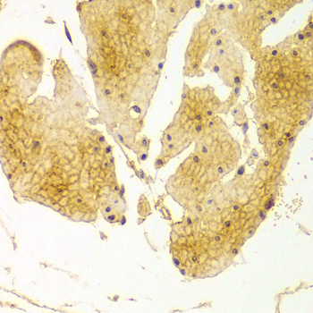 Basigin / Emmprin / CD147 Antibody - Immunohistochemistry of paraffin-embedded Human esophageal tissue.