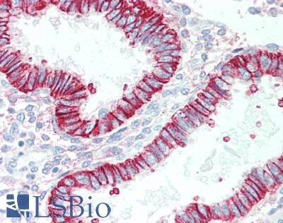 Basigin / Emmprin / CD147 Antibody - Human Uterus: Formalin-Fixed, Paraffin-Embedded (FFPE)