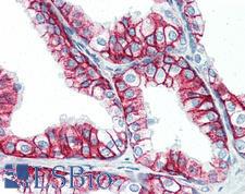 Basigin / Emmprin / CD147 Antibody - Anti-CD147 antibody IHC of human prostate. Immunohistochemistry of formalin-fixed, paraffin-embedded tissue after heat-induced antigen retrieval. Antibody concentration 10 ug/ml.