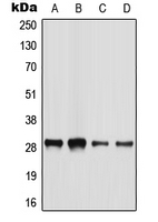 BATF2 / SARI Antibody - Western blot analysis of BATF2 expression in HeLa (A); HepG2 (B); mouse liver (C); rat liver (D) whole cell lysates.