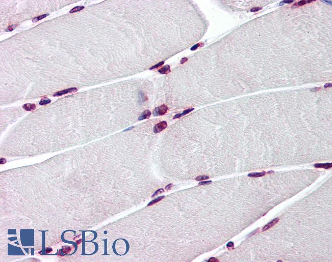 BAZ1B / WSTF Antibody - Anti-BAZ1B / WSTF antibody IHC of human skeletal muscle. Immunohistochemistry of formalin-fixed, paraffin-embedded tissue after heat-induced antigen retrieval. Antibody concentration 3 ug/ml.