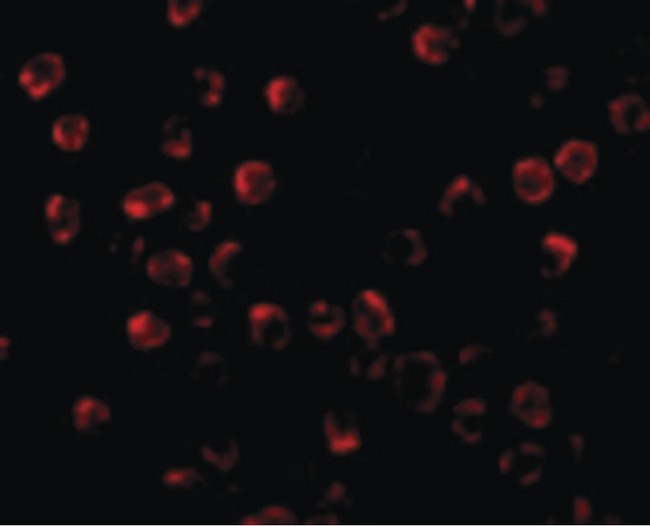 BBC3 / PUMA Antibody - Immunofluorescence of PUMA in K562 cells with PUMA antibody at 2 ug/ml.