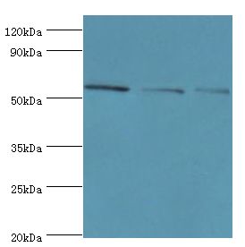 BBS4 Antibody - Western blot. All lanes: Bardet-Biedl syndrome 4 protein antibody at 4 ug/ml. Lane 1: HeLa whole cell lysate. Lane 2: U251 whole cell lysate. Lane 2: mouse heart tissue. secondary Goat polyclonal to rabbit at 1:10000 dilution. Predicted band size: 58 kDa. Observed band size: 58 kDa.