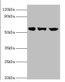 BBS4 Antibody - Western blot All lanes: Bardet-Biedl syndrome 4 protein antibody at 4µg/ml Lane 1: Hela whole cell lysate Lane 2: U251 whole cell lysate Lane 2: Mouse heart tissue Secondary Goat polyclonal to rabbit IgG at 1/10000 dilution Predicted band size: 59, 60, 39 kDa Observed band size: 59 kDa