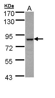 BBS7 Antibody - Sample (30 ug of whole cell lysate). A: A431. 7.5% SDS PAGE. BBS7 antibody diluted at 1:1000