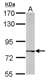 BBS7 Antibody - Sample (50 ug of whole cell lysate). A: mouse liver. 7.5% SDS PAGE. BBS7 antibody diluted at 1:1000.
