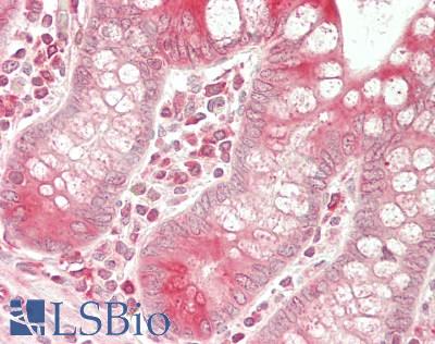 BCAP31 / BAP31 Antibody - Human Small Intestine: Formalin-Fixed, Paraffin-Embedded (FFPE)