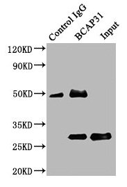 BCAP31 / BAP31 Antibody