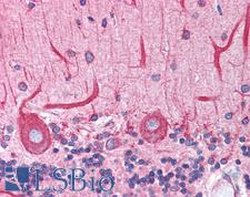 BCAP31 / BAP31 Antibody - Anti-BCAP31 / BAP31 antibody IHC of human brain, cerebellum. Immunohistochemistry of formalin-fixed, paraffin-embedded tissue after heat-induced antigen retrieval. Antibody concentration 3.75 ug/ml.