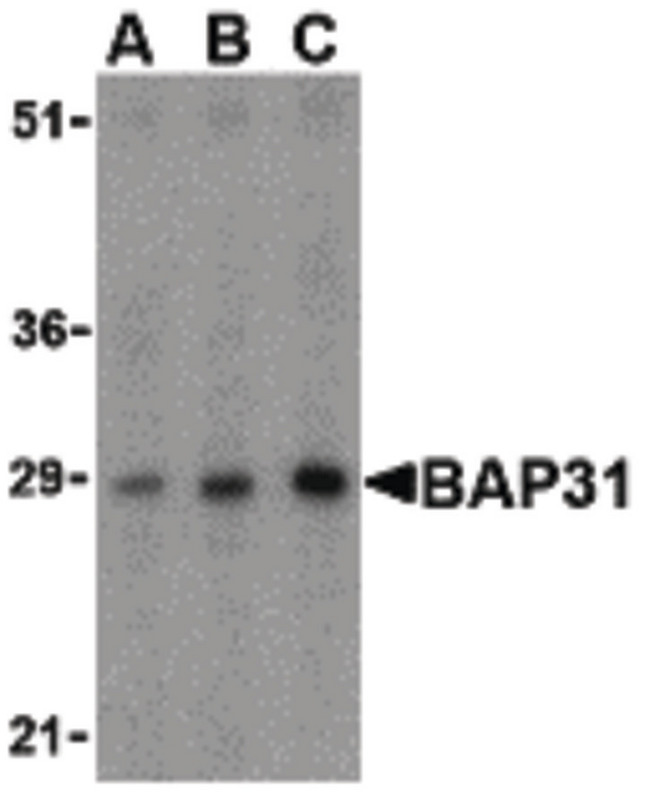 BCAP31 / BAP31 Antibody - Western blot of BAP31 in rat lung tissue lysate with BAP31 antibody at (A) 0.5, (B) 1 and (C) 2ug/ml.