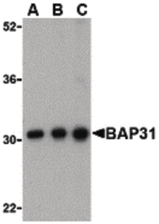 BCAP31 / BAP31 Antibody - Western blot of BAP31 in Ramos cell lysate with BAP31 antibody at (A) 0.5, (B) 1 and (C) 2ug/ml.