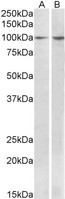BCAR1 / p130Cas Antibody - BCAR1 antibody (1 ug/ml) staining of MCF7 (A) and Human Breast cancer (B) lysates (35 ug protein in RIPA buffer). Primary incubation was 1 hour. Detected by chemiluminescence.