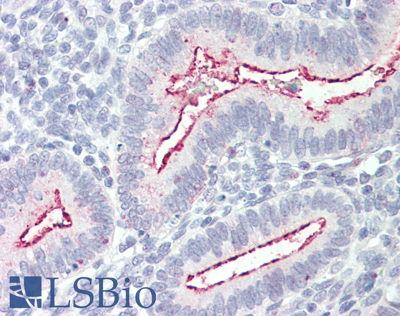 BCAR1 / p130Cas Antibody - Anti-BCAR1 / p130Cas antibody IHC staining of human uterus. Immunohistochemistry of formalin-fixed, paraffin-embedded tissue after heat-induced antigen retrieval. Antibody concentration 5 ug/ml.