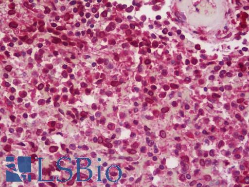 BCAR1 / p130Cas Antibody - Anti-BCAR1 / p130Cas antibody IHC staining of human spleen. Immunohistochemistry of formalin-fixed, paraffin-embedded tissue after heat-induced antigen retrieval. Antibody dilution 1:100.