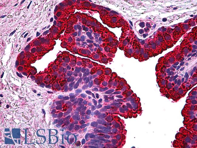 BCAS1 / NABC1 Antibody - Anti-BCAS1 / NABC1 antibody IHC of human prostate. Immunohistochemistry of formalin-fixed, paraffin-embedded tissue after heat-induced antigen retrieval. Antibody concentration 5 ug/ml.