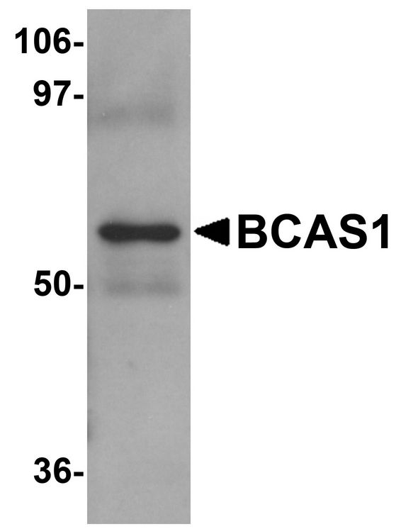 BCAS1 / NABC1 Antibody - Western blot analysis of BCAS1 in human lung tissue lysate with BCAS1 antibody at 1 ug/ml.