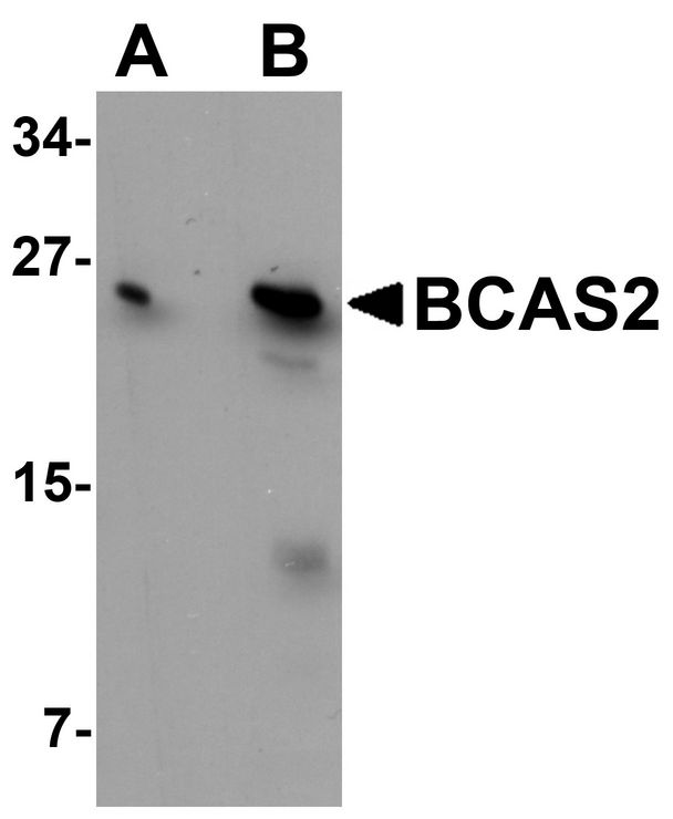 BCAS2 Antibody - Western blot analysis of BCAS2 in MCF7 cell lysate with BCAS2 antibody at (A) 0.5 and (B) 1 ug/ml.