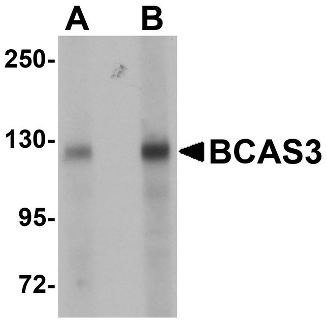 BCAS3 Antibody - Western blot analysis of BCAS3 in rat brain tissue lysate with BCAS3 antibody at (A) 0.5 and (B) 1 ug/ml.