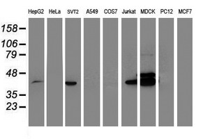BCAT1 / ECA39 Antibody - Western blot of extracts (35 ug) from 9 different cell lines by using anti-BCAT1 monoclonal antibody.