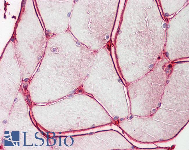 BCHE / Cholinesterase Antibody - Anti-BCHE / Cholinesterase antibody IHC of human skeletal muscle. Immunohistochemistry of formalin-fixed, paraffin-embedded tissue after heat-induced antigen retrieval. Antibody dilution 1:200.