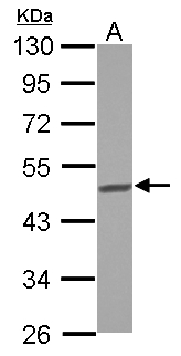 BCKDHA / BCKDE1A Antibody - Sample (30 ug of whole cell lysate) A: HepG2 10% SDS PAGE BCKDHA antibody diluted at 1:1000