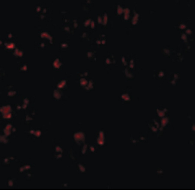 BCL10 / BCL-10 Antibody - Immunofluorescence of Bcl-10 in Raji cells with Bcl-10 antibody at 10 ug/ml.
