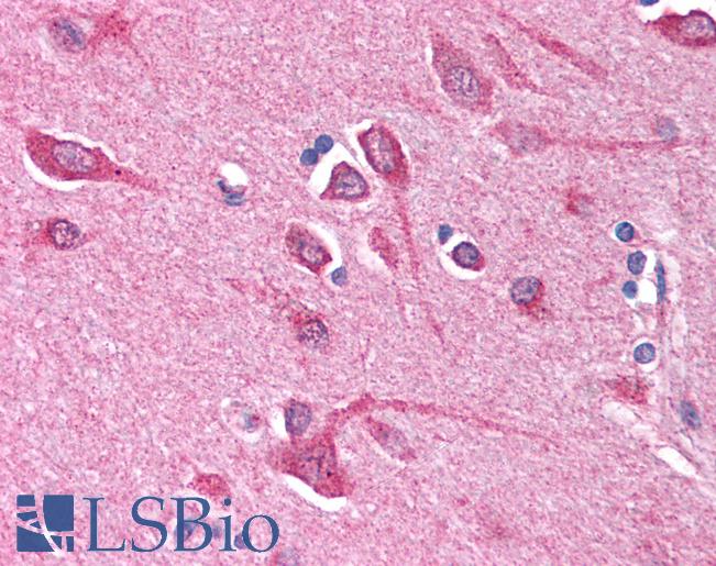 BCL10 / BCL-10 Antibody - Anti-BCL10 antibody IHC of human brain, cortex. Immunohistochemistry of formalin-fixed, paraffin-embedded tissue after heat-induced antigen retrieval. Antibody concentration 5 ug/ml.