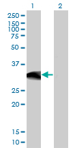 BCL11A Antibody - Western blot of BCL11A expression in transfected 293T cell line by BCL11A monoclonal antibody, clone 3D9.