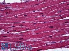 BCL11A Antibody - Anti-BCL11A antibody IHC of human heart. Immunohistochemistry of formalin-fixed, paraffin-embedded tissue after heat-induced antigen retrieval. Antibody concentration 5 ug/ml.