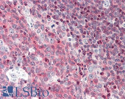 BCL11A Antibody - Human Tonsil: Formalin-Fixed, Paraffin-Embedded (FFPE)