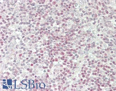 BCL11B Antibody - Human Tonsil: Formalin-Fixed, Paraffin-Embedded (FFPE)