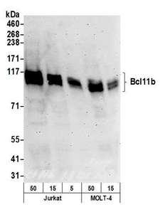 BCL11B Antibody - Detection of human Bcl11b by western blot. Samples: Whole cell lysate (50, 15, 5 µg) from Jurkat and (50, 15 µg) MOLT-4 cells prepared using NETN lysis buffer. Antibodies: Affinity purified rabbit anti-Bcl11b antibody used for WB at 0.1 µg/ml. Detection: Chemiluminescence with an exposure time of 3 minutes.