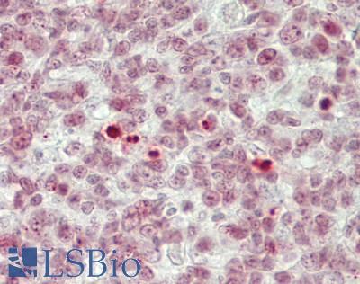 BCL11B Antibody - Human Tonsil: Formalin-Fixed, Paraffin-Embedded (FFPE)