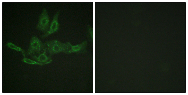 BCL2 / Bcl-2 Antibody - Immunofluorescence analysis of HepG2 cells, using BCL-2 Antibody. The picture on the right is blocked with the synthesized peptide.