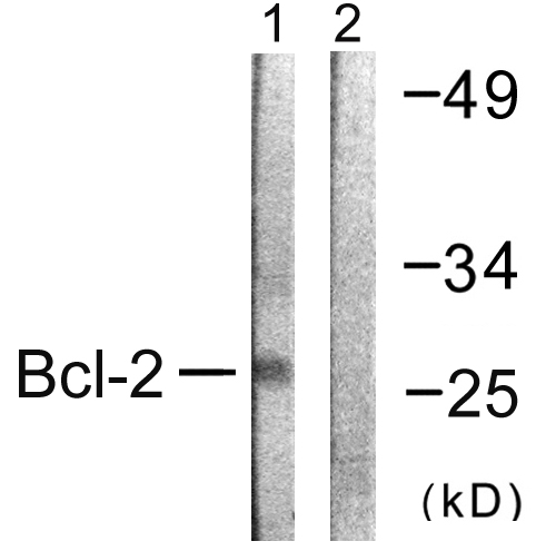 BCL2 / Bcl-2 Antibody - Western blot analysis of lysates from K562 cells, using BCL-2 Antibody. The lane on the right is blocked with the synthesized peptide.