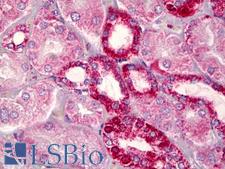 BCL2 / Bcl-2 Antibody - Anti-BCL2 / Bcl-2 antibody IHC of human kidney, tubules. Immunohistochemistry of formalin-fixed, paraffin-embedded tissue after heat-induced antigen retrieval. Antibody dilution 1:100.